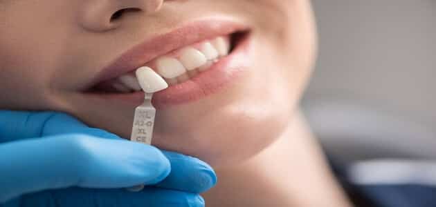 هل تلبيس الاسنان مؤلم